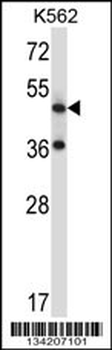 TACR3 Antibody (C-term)