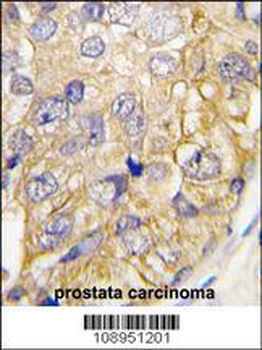 DRAGON (RGMB) Antibody (C-term)