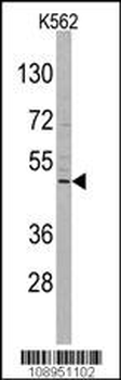 DRAGON (RGMB) Antibody (C-term)
