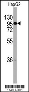 CHRD Antibody (C-term)