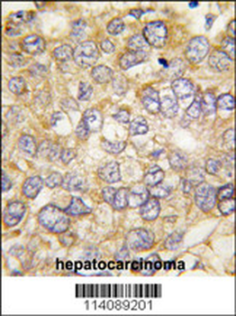 CHRD Antibody (C-term)