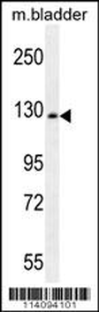 CHRD Antibody (N-term)