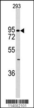 K Cadherin (CDH6) Antibody (C-term)