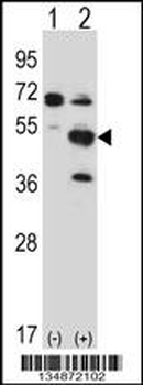 Mouse Pxk Antibody (Center)