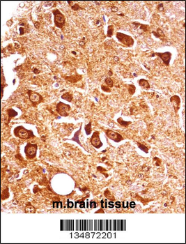 Mouse Pxk Antibody (Center)