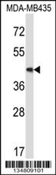 Mouse Map2k5 Antibody (C-term)