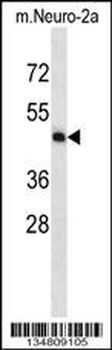 Mouse Map2k5 Antibody (C-term)