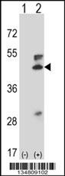 Mouse Map2k5 Antibody (C-term)