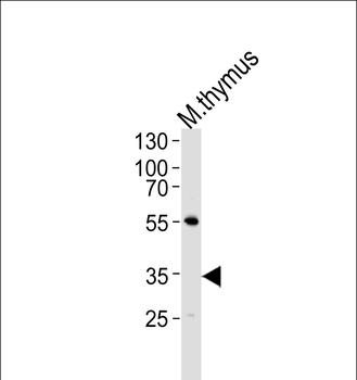 Mouse Lck Antibody (N-term)
