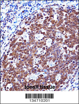 ZAP70 Antibody (Center)