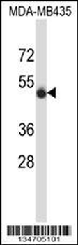 SPN/CD43 Antibody (N-term)