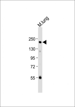 Mouse Mst1r Antibody (C-term)