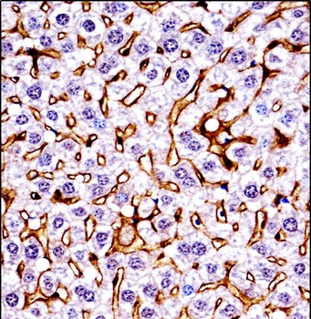 Mouse Mst1r Antibody (C-term)