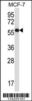MAPKAP1 Antibody (C-term)