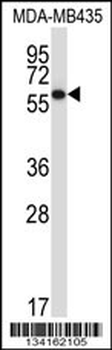 PDIA5 Antibody (C-term)