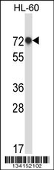 RBM39 Antibody (N-term)