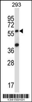 SOCS6 Antibody (N-term)