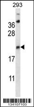 AES Antibody (C-term)