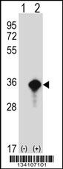 AES Antibody (C-term)