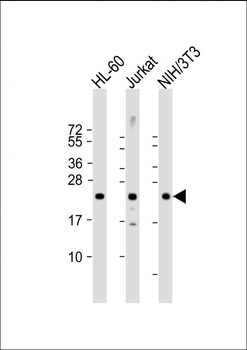 RHOC Antibody (C-term)