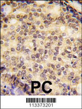 SOX9 Antibody (N-term)