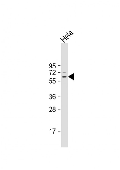 BECN1 Antibody (N-term T72)