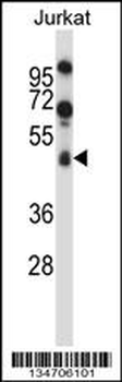 SPN/CD43 Antibody (Center)