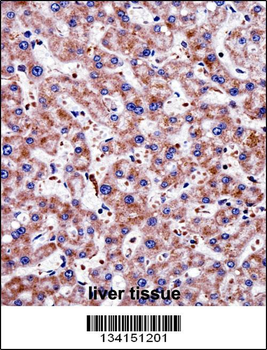 TAGLN2 Antibody (C-term)