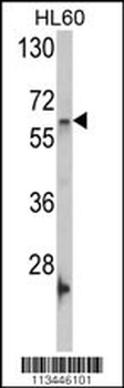 Nucleostemin (GNL3) Antibody (C-term)