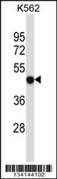 P2RX5 Antibody (C-term)