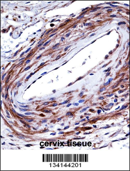 P2RX5 Antibody (C-term)