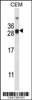 CIDEA Antibody (C-term)