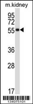 SSTR1 Antibody (C-term)