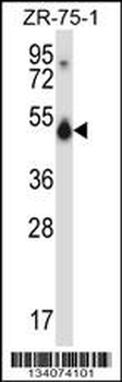 CUGBP1 Antibody (N-term)