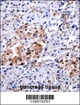 CUGBP1 Antibody (N-term)