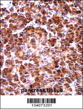 USO1 Antibody (C-term)