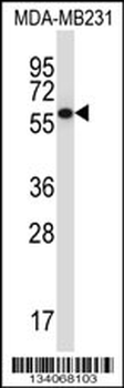 PPP2R5C Antibody (C-term)