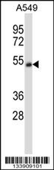 CHRNA5 Antibody (Center)