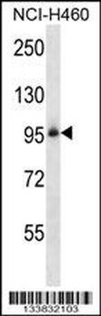 ITGB5 Antibody (N-term)