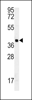 GDPD3 Antibody (N-term)
