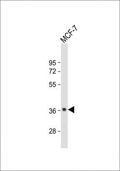 GDPD3 Antibody (N-term)