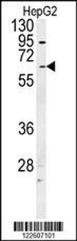 UGT1A1 Antibody (N-term)