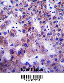 UGT1A1 Antibody (N-term)