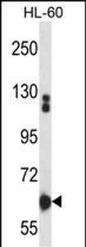 Mouse Itk Antibody (N-term)