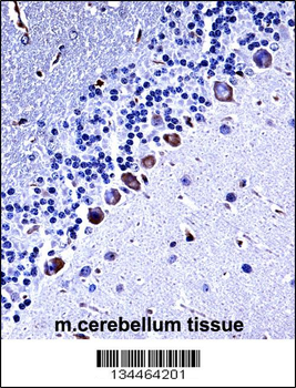 Mouse Csnk1g3 Antibody (C-term)