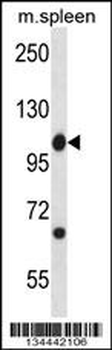 Mouse Abl1 Antibody (Center)