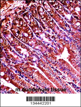 Mouse Abl1 Antibody (Center)