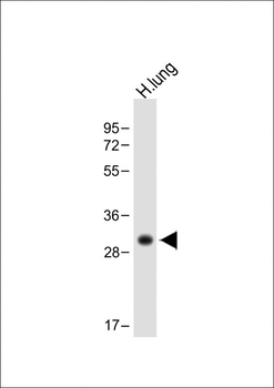 HLA-DPB1 Antibody (Center)