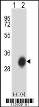 HLA-DPB1 Antibody (Center)