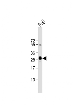 HLA-DPB1 Antibody (Center)